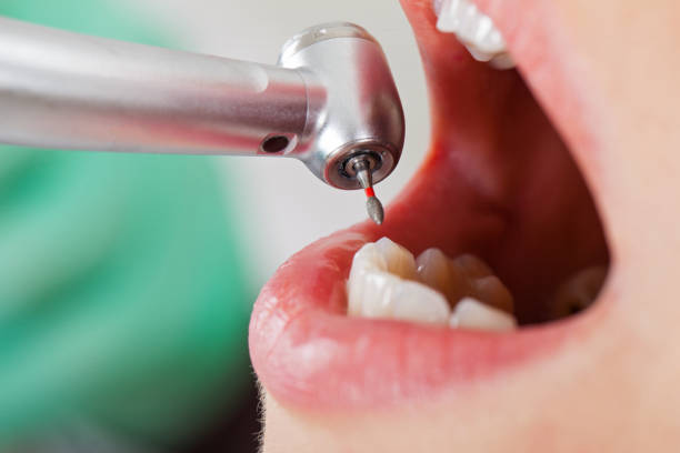 Best Dental Abscess Treatment in Yorkville, WI